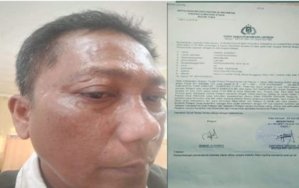 Jurnalis Dianiaya Saat Liput Galian C Ilegal di Toba, DPD PJS Minta Tindakan Tegas